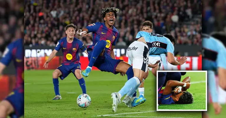 লামিন ইয়ামালের ইনজুরি